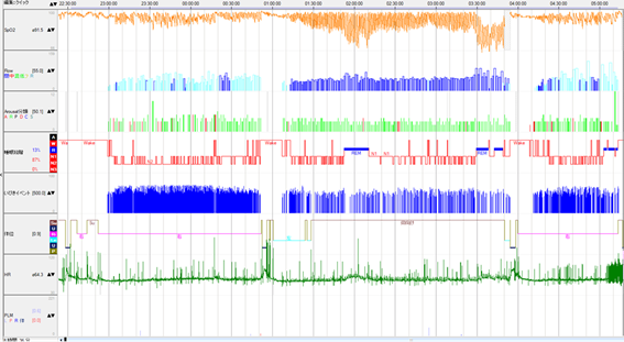  AFiB で睡眠を改善するためのヒント