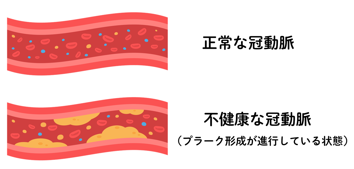 スライド2 1 - コピー.PNG